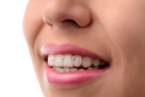 How An Invisalign Dentist Can Make You Confident in Your Grin Again Blog General & Preventive Dentistry 